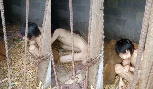 小伙子因为精神有问题,被家人圈养10年,如同牲畜一样!                     thumbnail