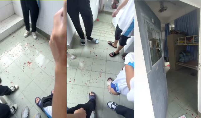 
                        网传顺德中专汽修两个小畜生打完同学后，用玻璃碎片挑断了人家的手筋                     thumbnail